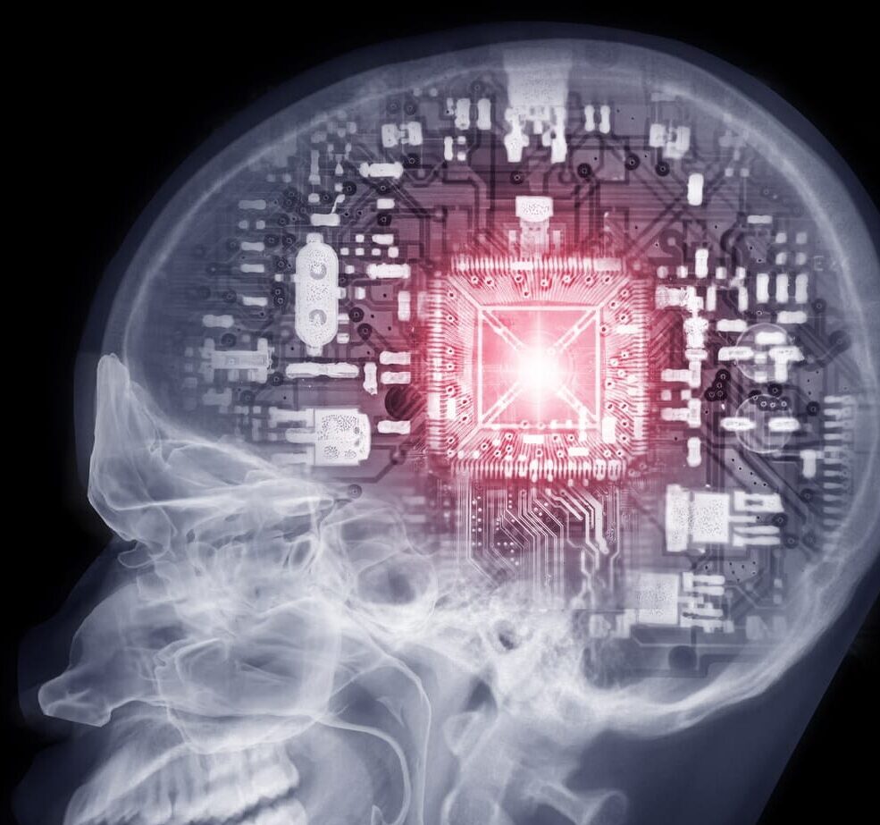 An artificial intelligence CPU is installed in the skull.